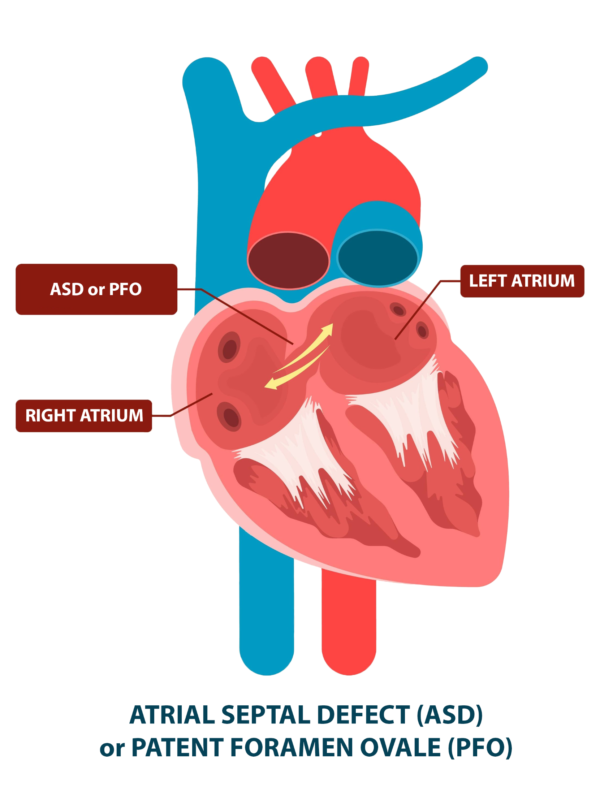 Structural Heart Disease