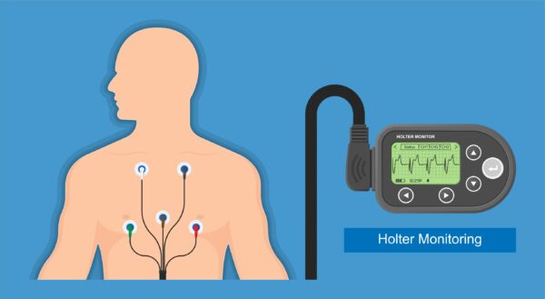 Holter & Event Monitors